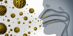 Sinusitis