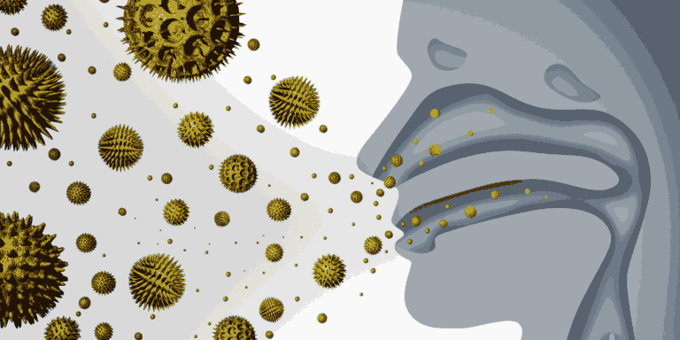 Sinusitis