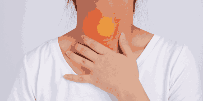 strep throat bacteria Streptococcus pyogenes