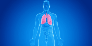 acute bronchitis
