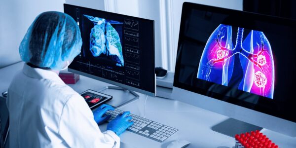 Acute Bronchitis vs. Pneumonia – Key Symptoms Doctors Compare 