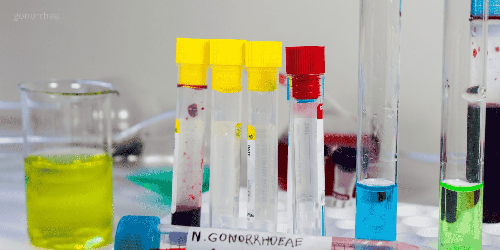 gonorrhea infection treatment