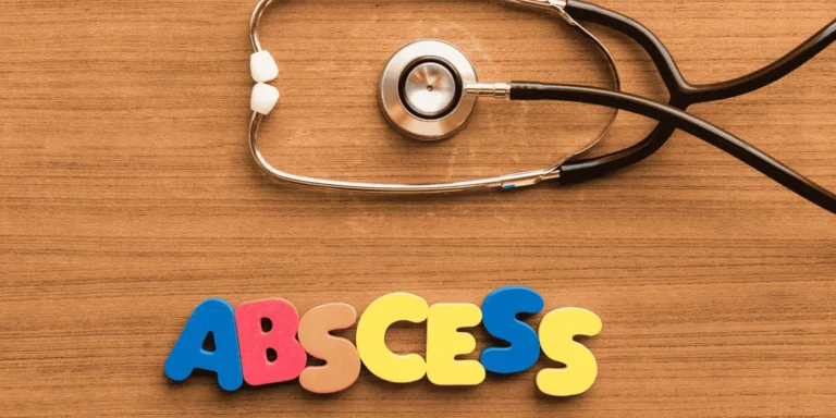 boils abscesses