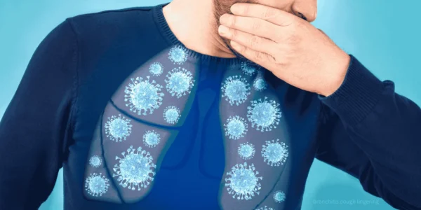 bronchitis cough lingering