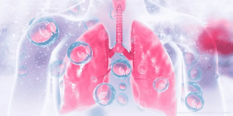 pneumonia complications smokers