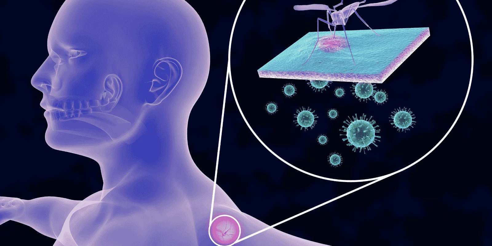 climate change and tick-borne illnesses