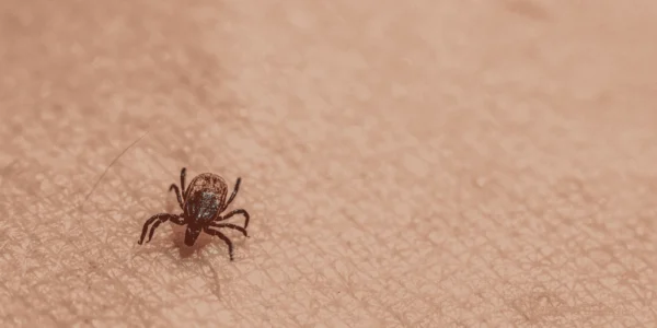 Tick-Borne Diseases