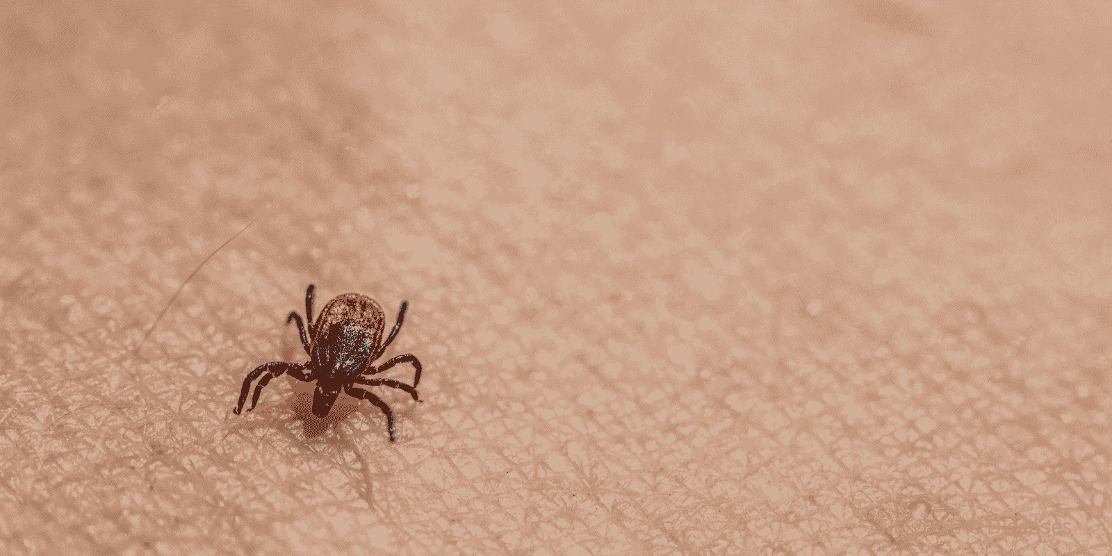 Tick-Borne Diseases