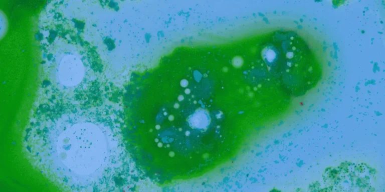 green mucus bacterial infection